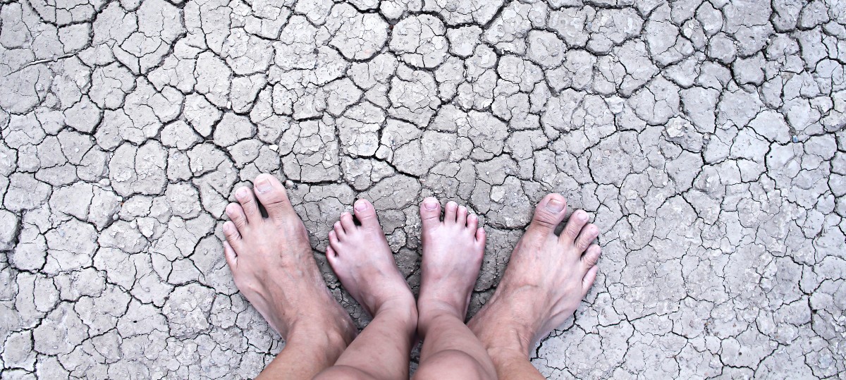 Why Do I have Dry Feet or Cracked Feet? Advanced Ankle & Foot